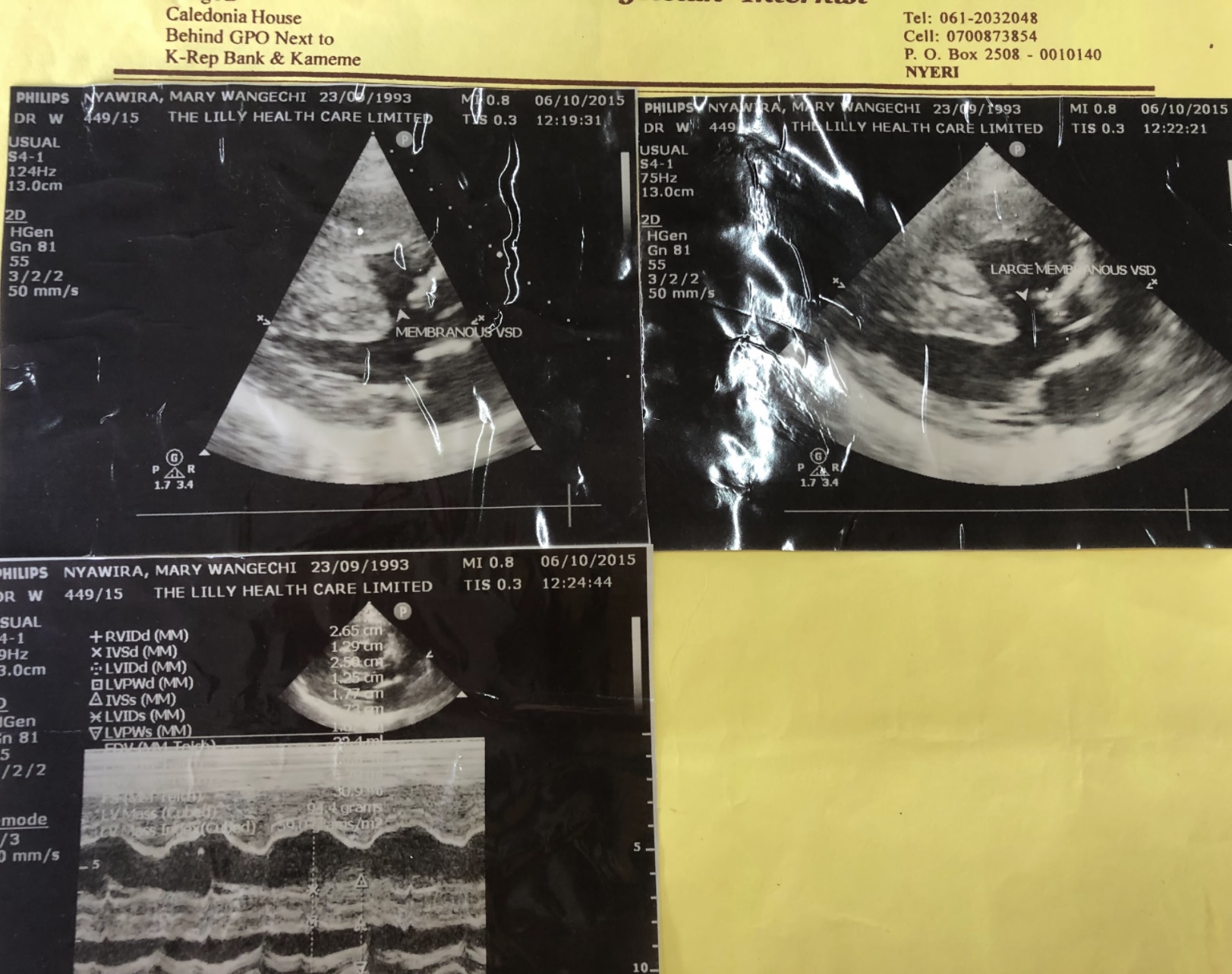 An ultrasound image reviewed by the medical team